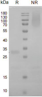Recombinant Human Noggin Protein _ 92623ES