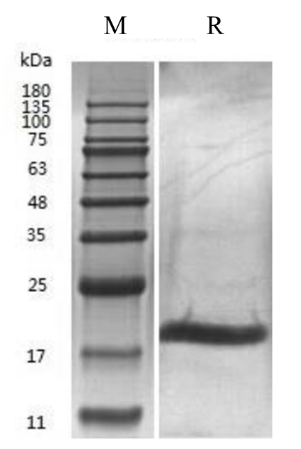 Human IL-21 Protein (CHO) _ 90266ES