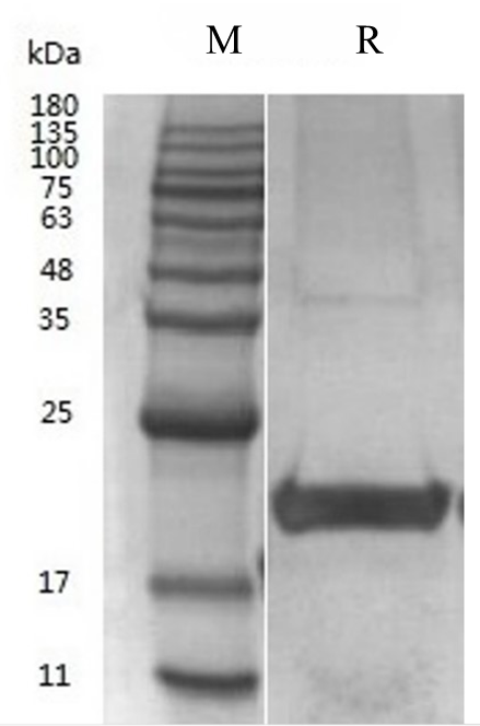 Human IL-18 Protein (CHO) _ 90265ES