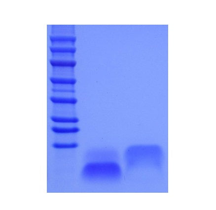 Protéine EGF humaine recombinante _ 92708ES