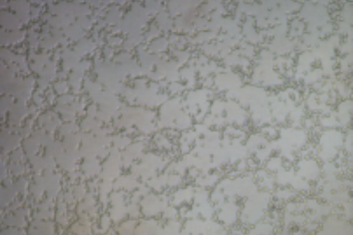 Angiogenesis Assay Case Study 5