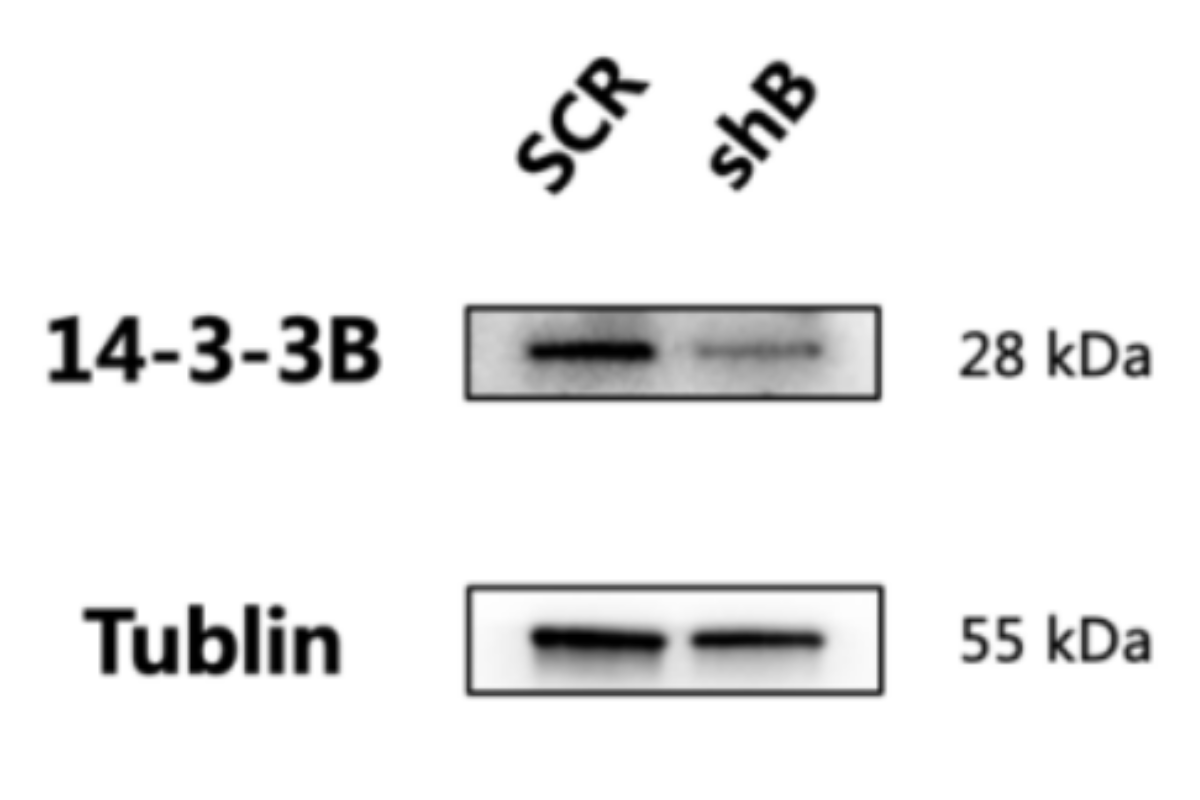Cell Transfection | HUVEC (Human umbilical vein endothelial cell) Cells Transfection – shRNA