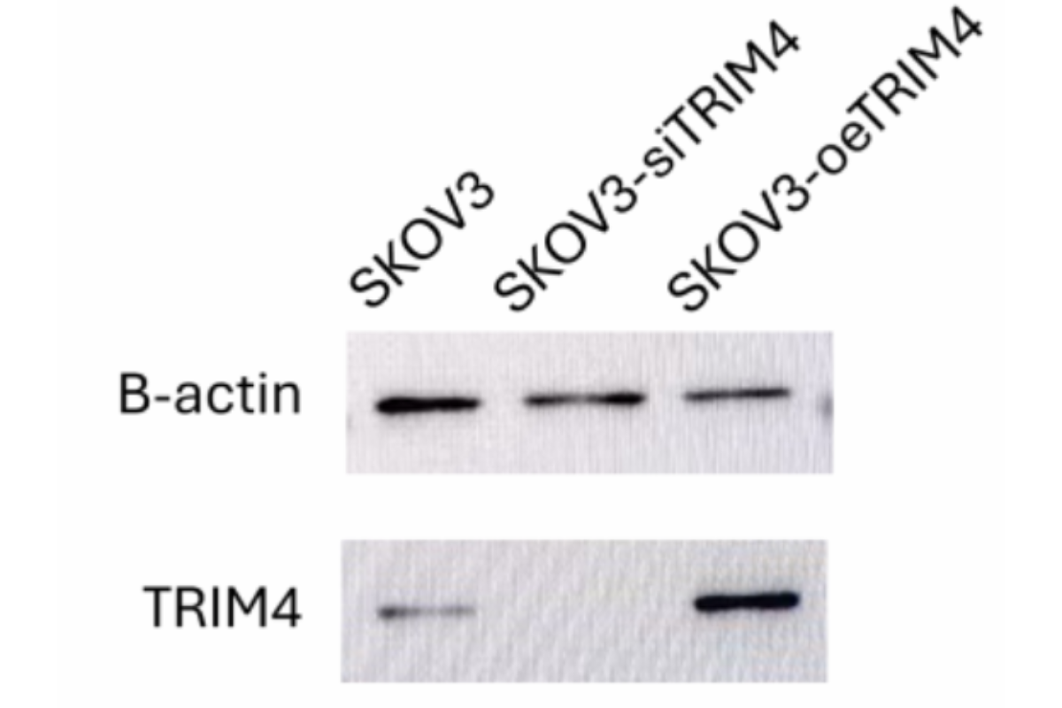 Cell Transfection | Co-transfection of DNA and siRNA in SKOV3 Human Ovarian Cancer Cells