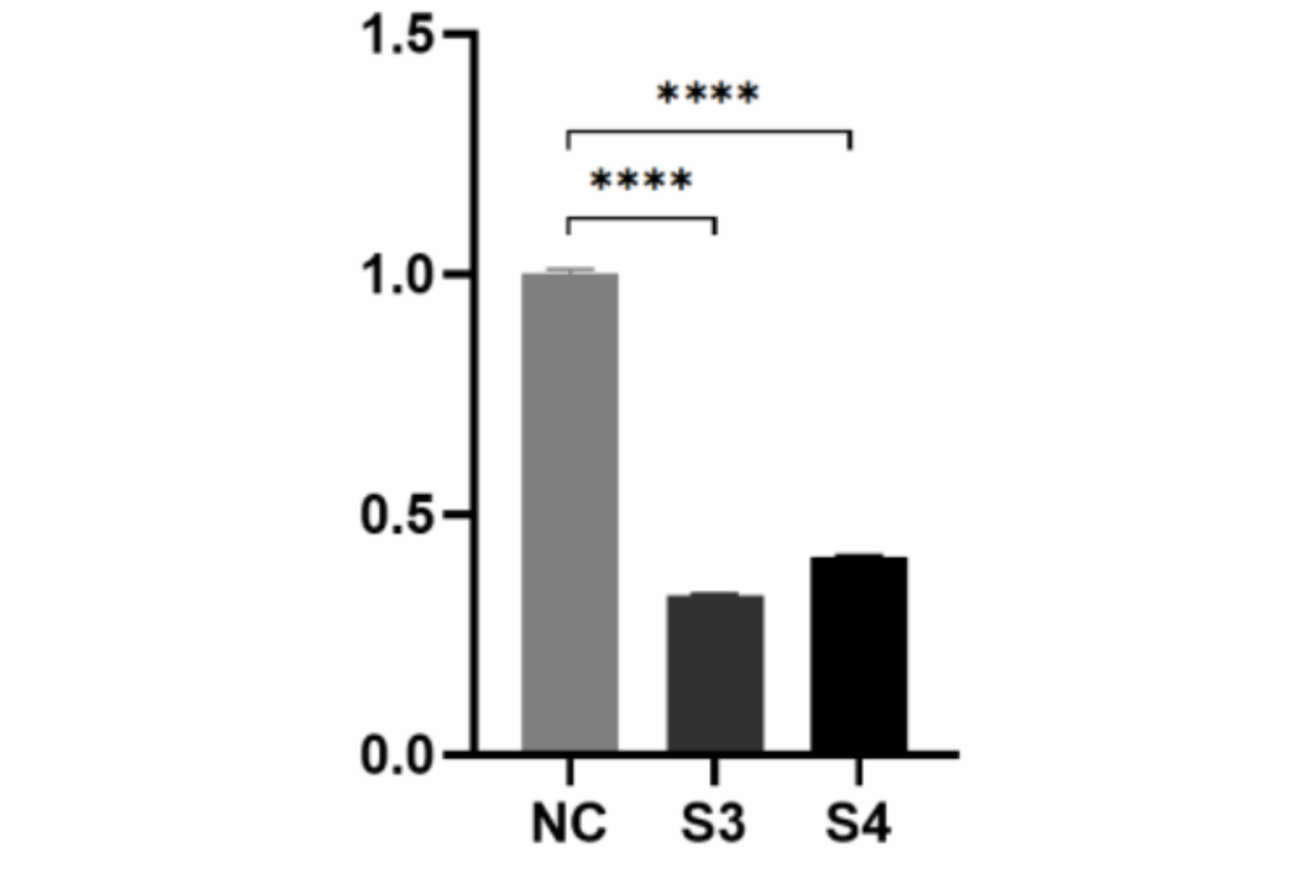 Cell Transfection | SiHa (Squamous Carcinoma of the Human cervix) Cells Transfection – siRNA