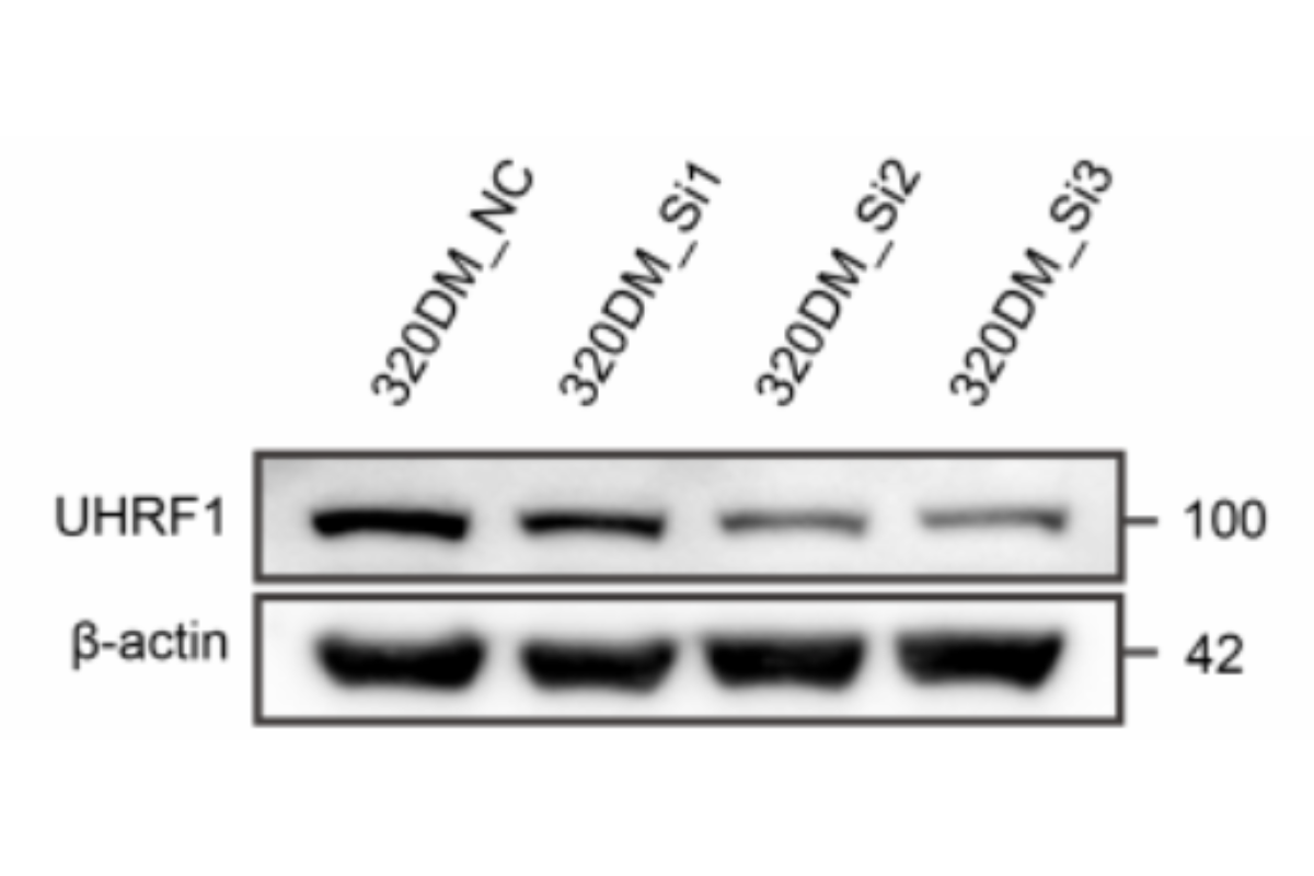 Cell Transfection | COLO320DM (Human Colorectal Adenocarcinoma Cells) Cells Transfection – siRNA