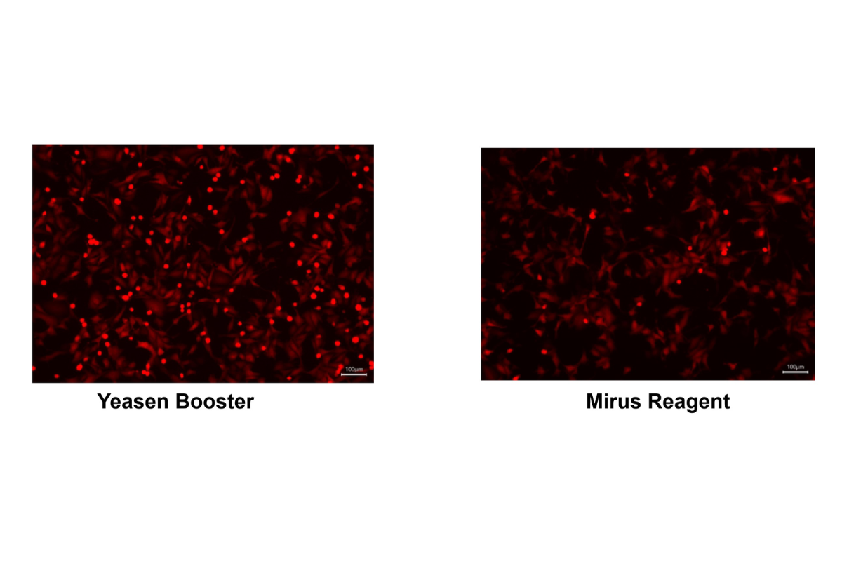 Cell Transfection | Transfection of BHK-21(Mouse Bone Marrow–Derived Dendritic Cells)-DNA