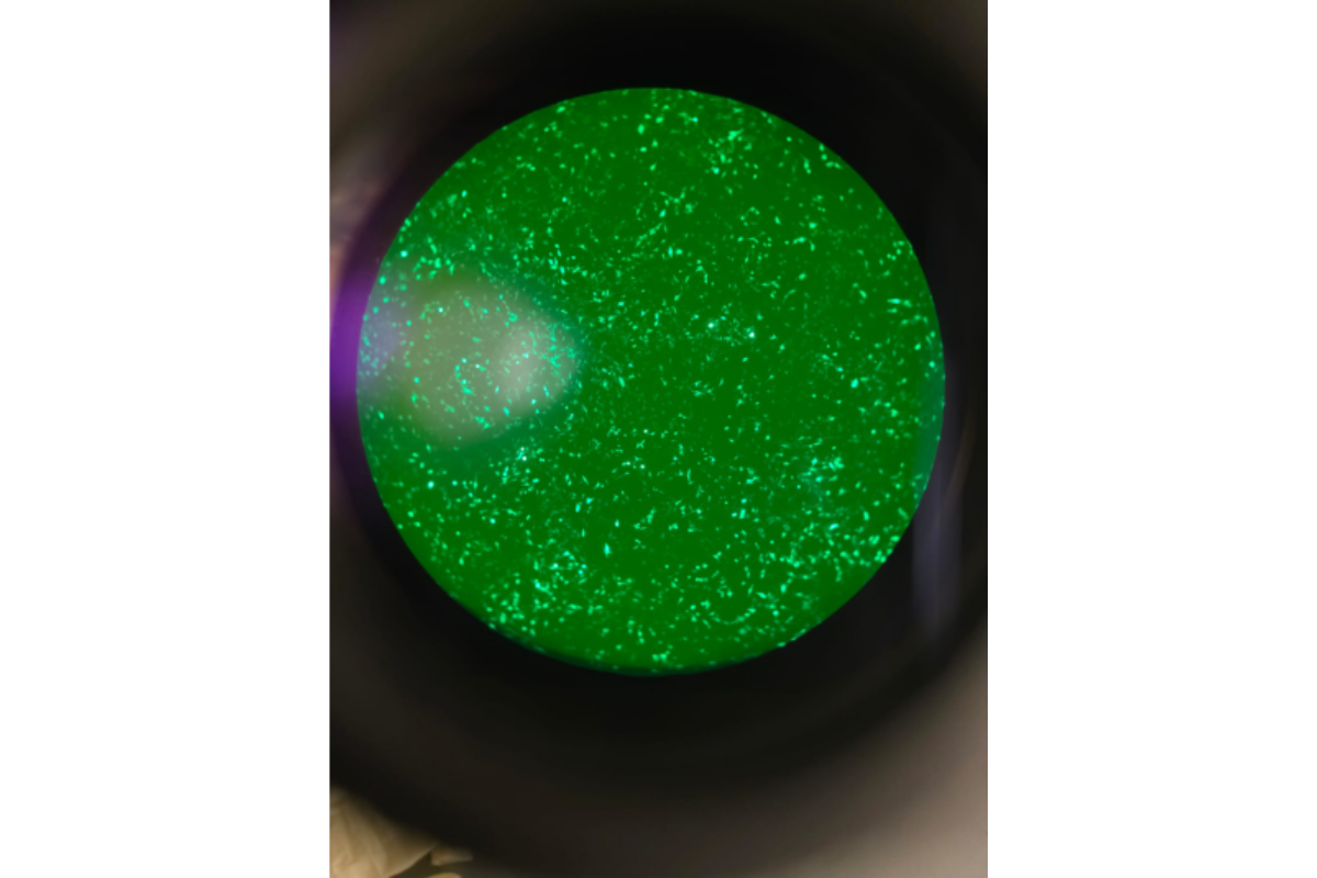 Cell Transfection | Transfection of C2C12 Mouse Myoblasts-DNA