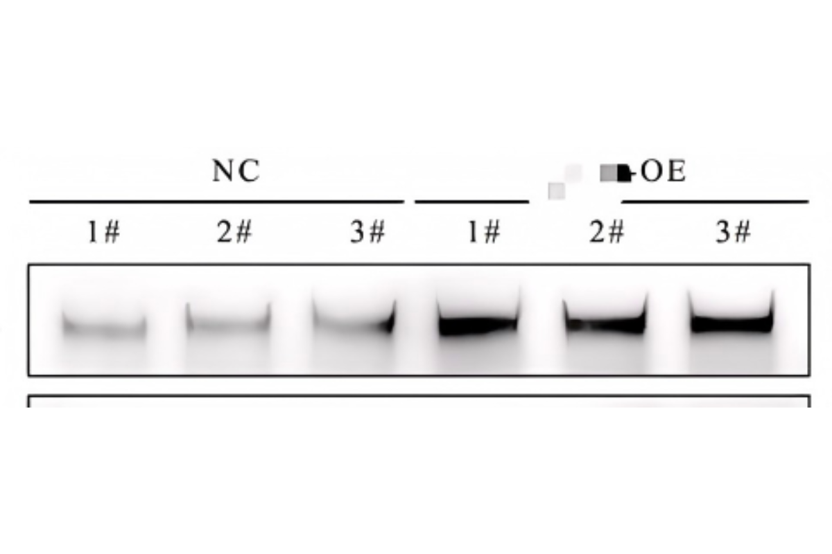 Cell Transfection | BMM (Bone marrow-derived macrophage) Cells Transfection – saRNA