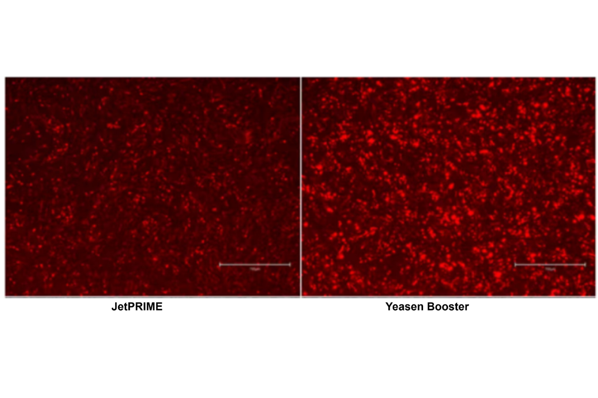 Cell Transfection | Transfection of CHO Chinese Hamster Ovary Cells-DNA