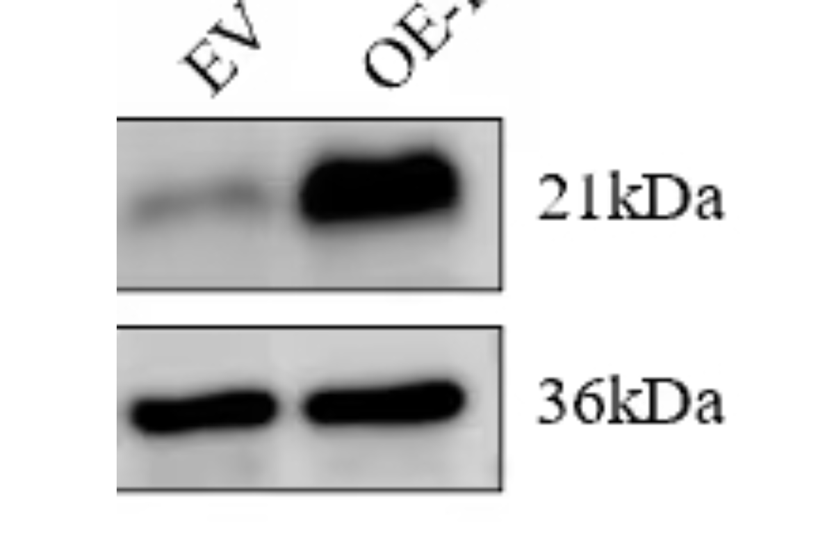 Cell Transfection | Transfection of HCT116 (Human colon cancer cells )-DNA