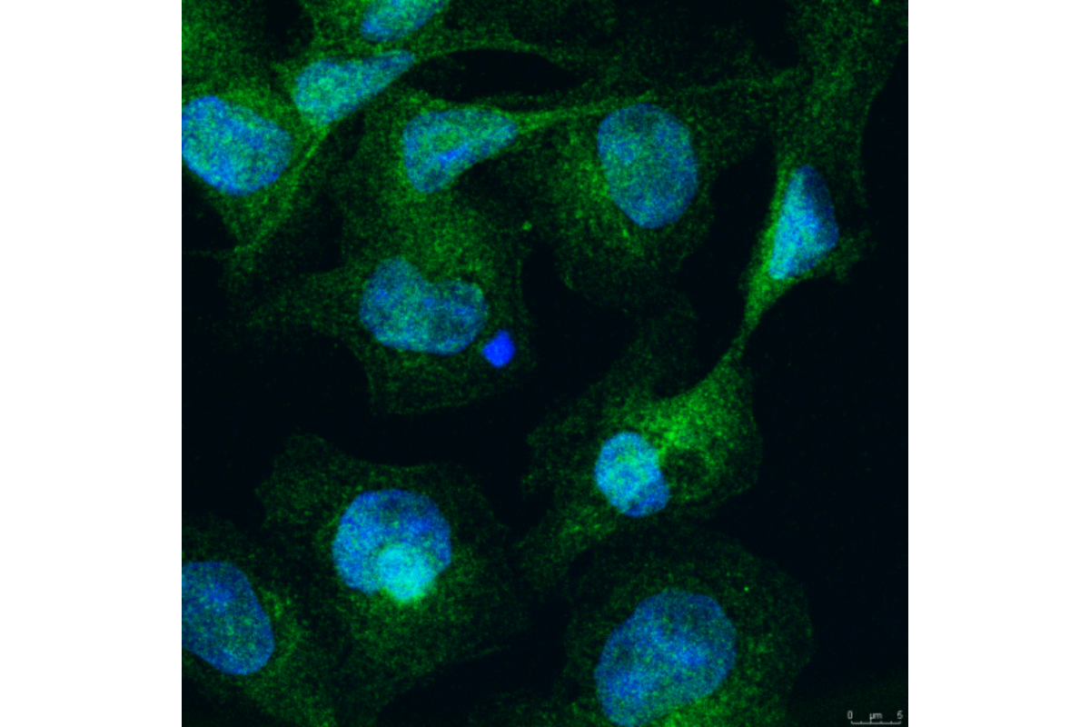 Cell Transfection | Transfection of PLC (Human Hepatoblastoma Cells)-DNA