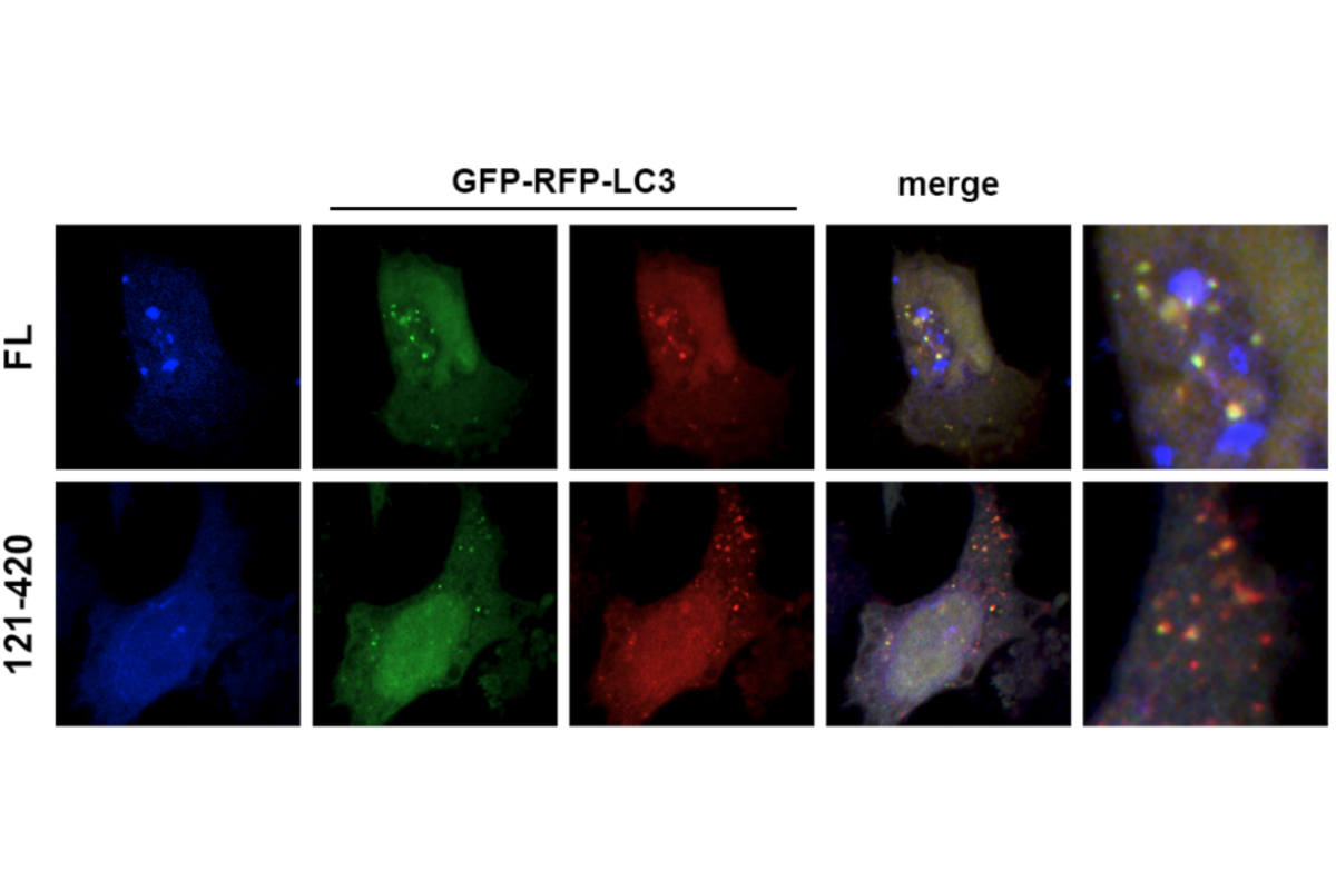 Cell Transfection | Transfection of Hela (Human cervical cancer cells)-DNA((co-transfection with two plasmids)