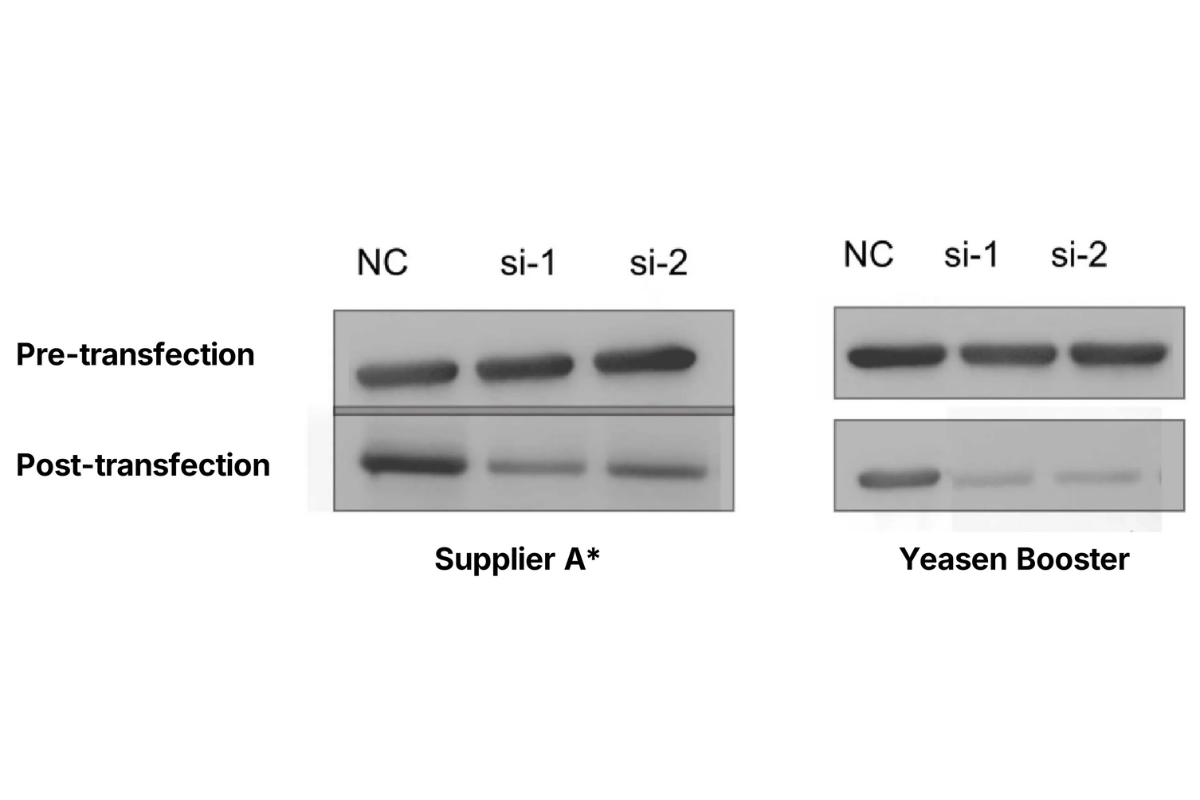 Cell Transfection | U78 (Human Glioblastoma Cells) Cells Transfection – siRNA