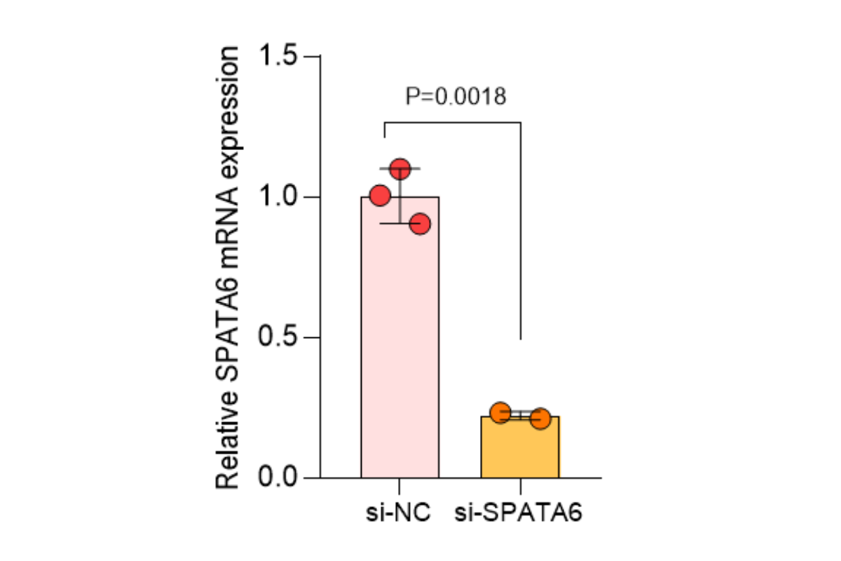 Cell Transfection | MCF (Mouse cardiac fibroblast) Cells Transfection – siRNA