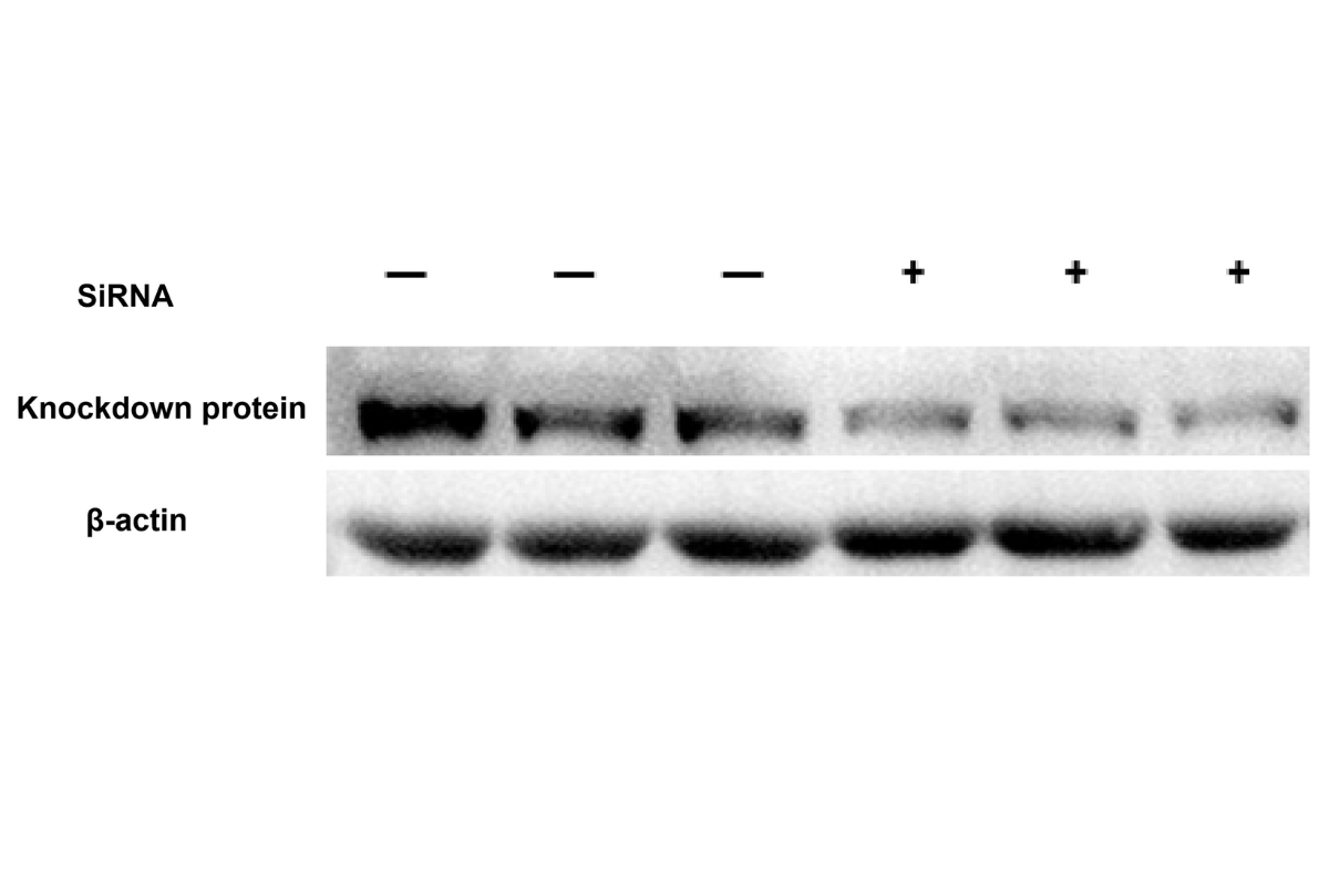 Cell Transfection | NIH-3T3 (Mouse embryonic fibroblast) Cell Transfection – siRNA