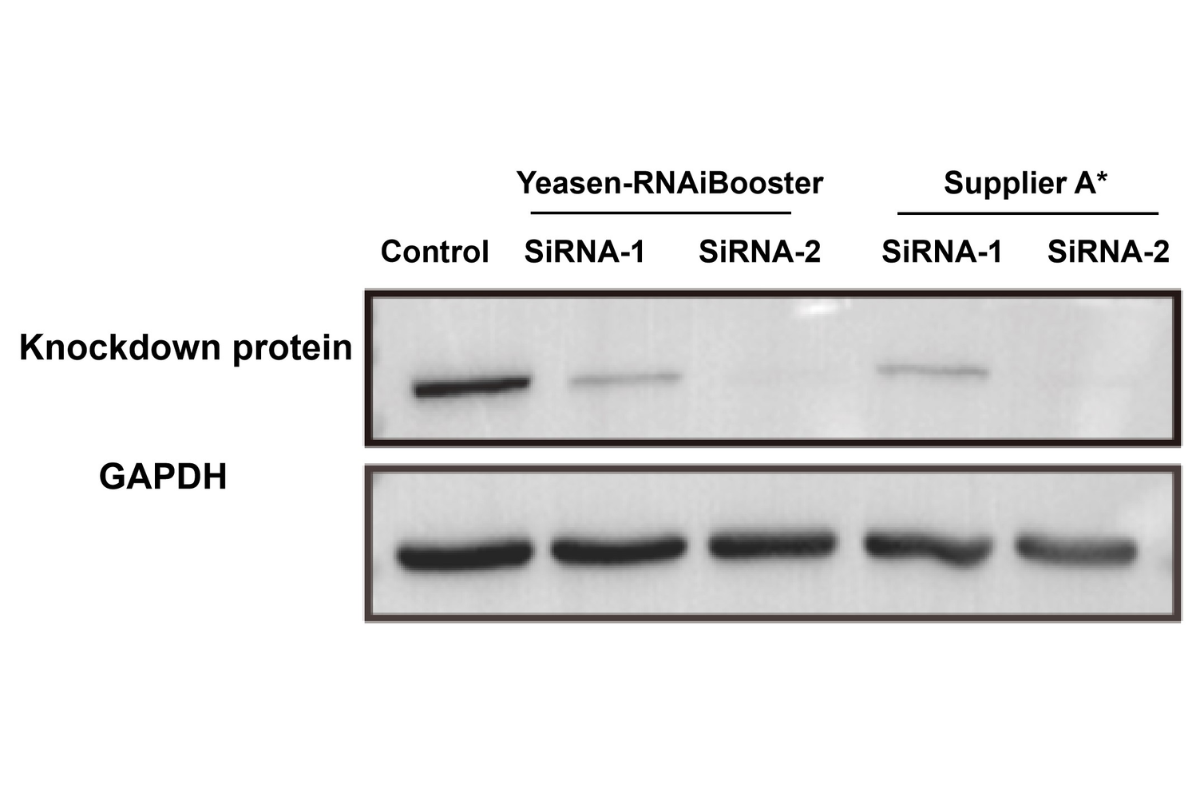 Cell Transfection | RAW264.7 (Mouse monocyte/macrophage cell) Cells Transfection – siRNA