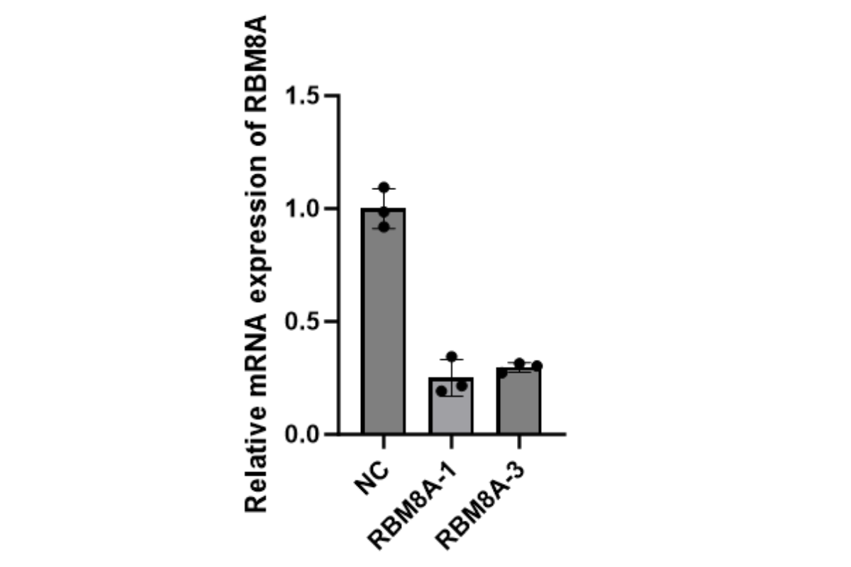 Cell Transfection | RBE (Rat bile duct epithelial cell) Transfection – siRNA