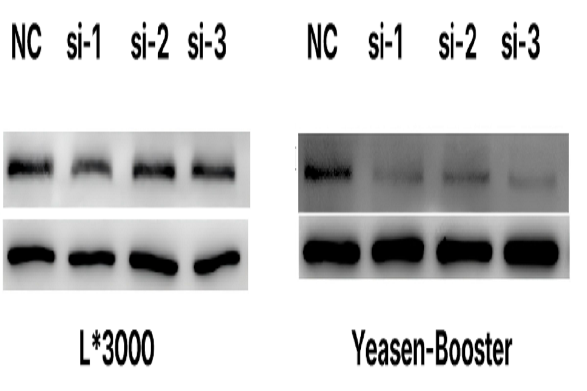 Cell Transfection | AC16 Human Cardiomyocytes Cells Transfection – siRNA