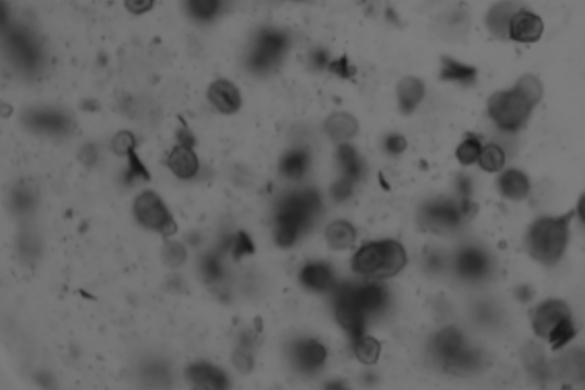 Organoid Construction | Endometrial Organoid Culture Case