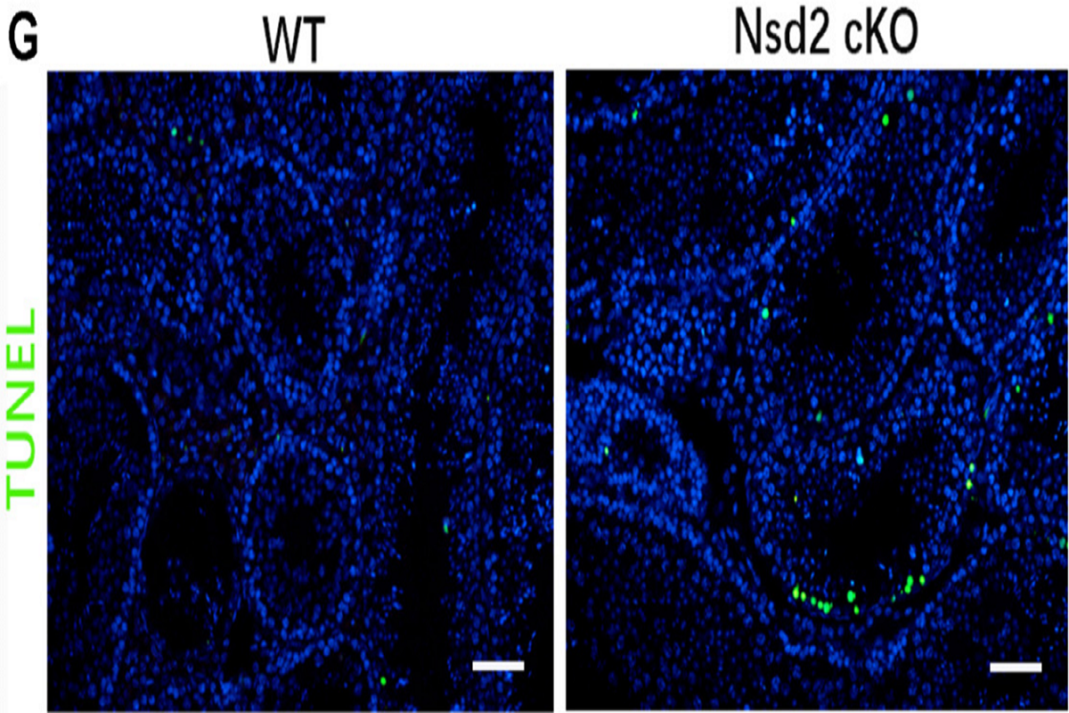 How Much Do You Know About TUNEL Staining? A Troubleshooting Guide for Abnormal Staining Results