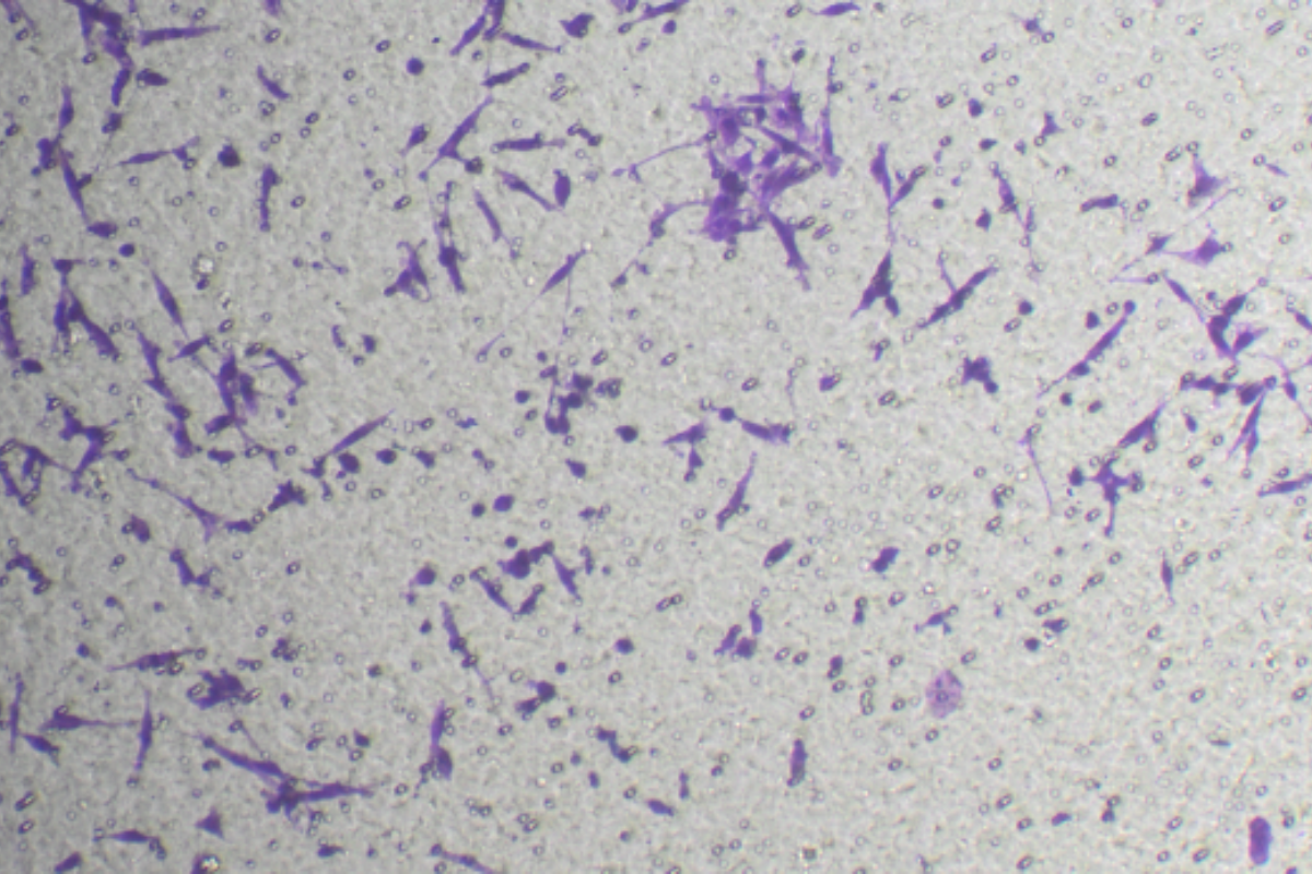 Cell Invasion Assay: Cervical Cancer (SiHa) Cell Invasion Model