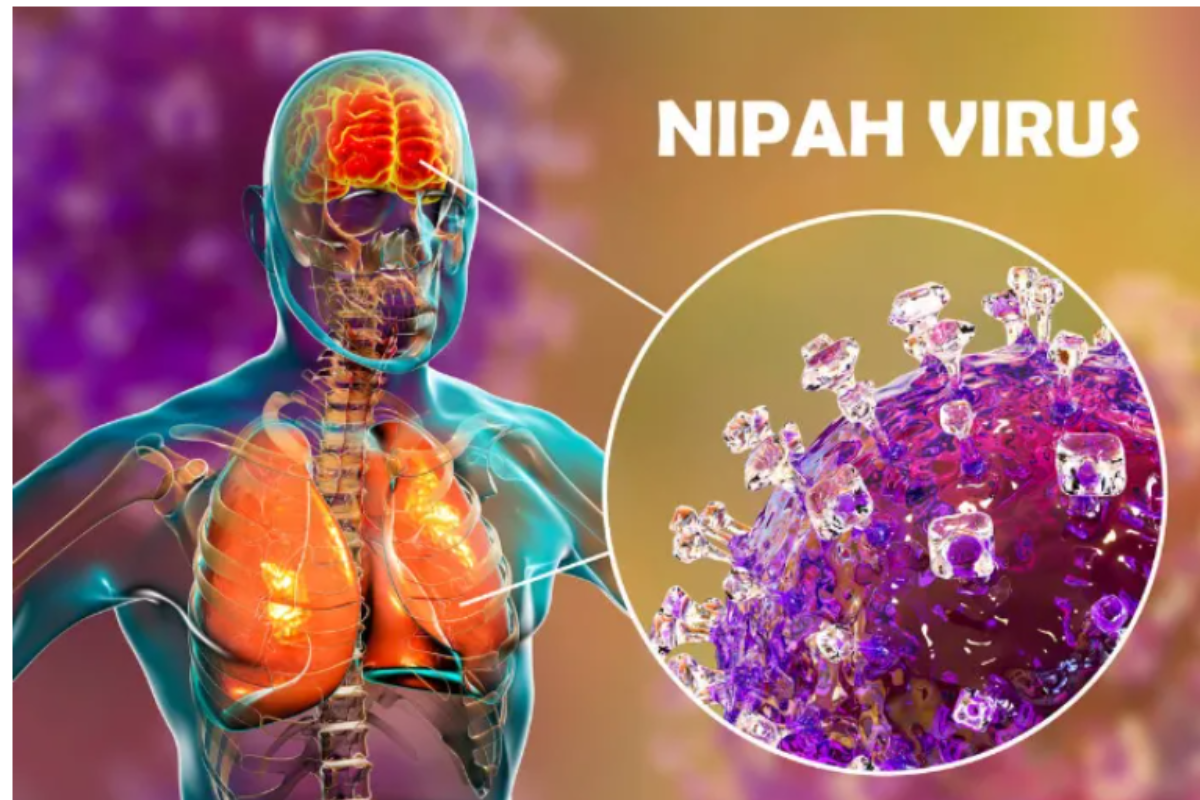 Fast, Accurate, and Reliable Molecular Diagnostic Solutions for Nipah Virus Surveillance