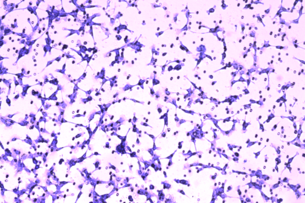 Cell Invasion Assay: Murine Colon Cancer (CT26) Cell Invasion Model