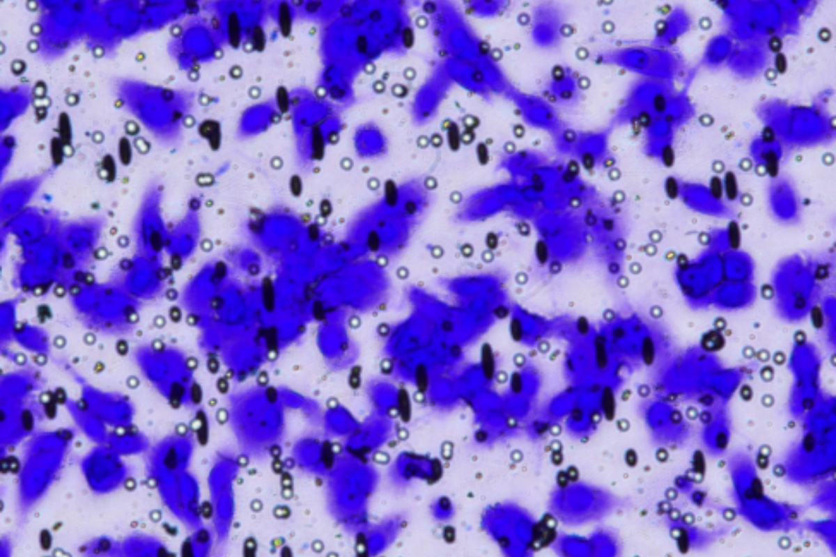 Cell Invasion Assay: Human Glioblastoma (U-87) Cell Invasion Model
