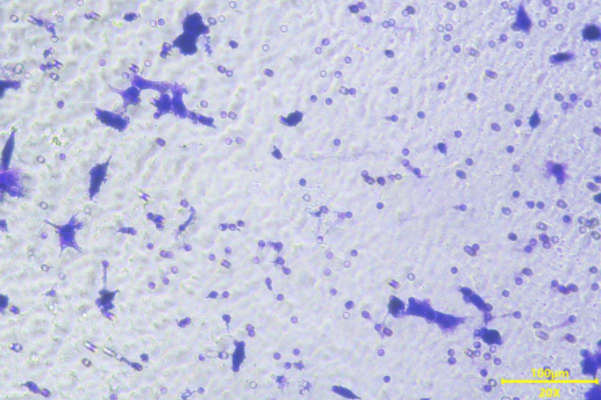 Cell Invasion Assay: Endometrial Cancer (AN3CA) Cell Invasion Model