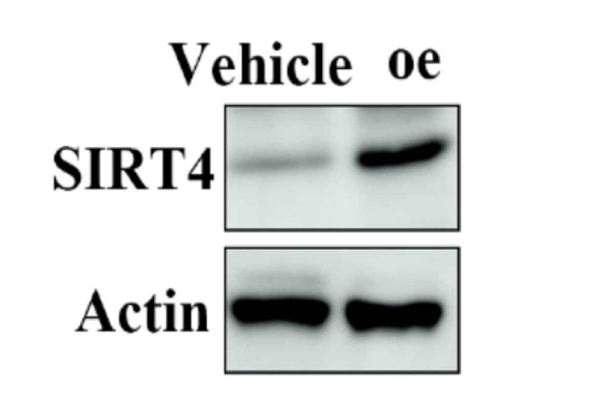 Cell Transfection | AGS Human Gastric Adenocarcinoma Cells Transfection – DNA