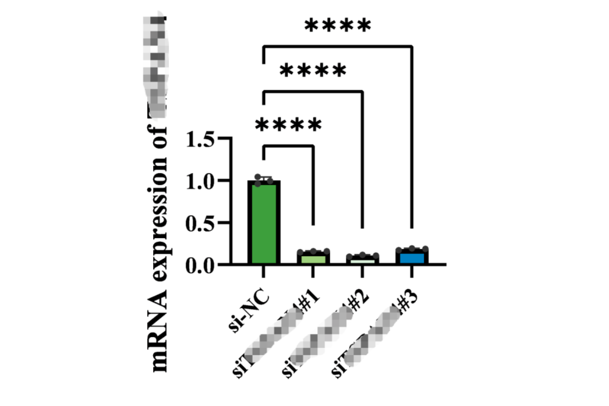 Cell Transfection | HUVEC (Primary human umbilical vein endothelial cells) Cells Transfection – siRNA