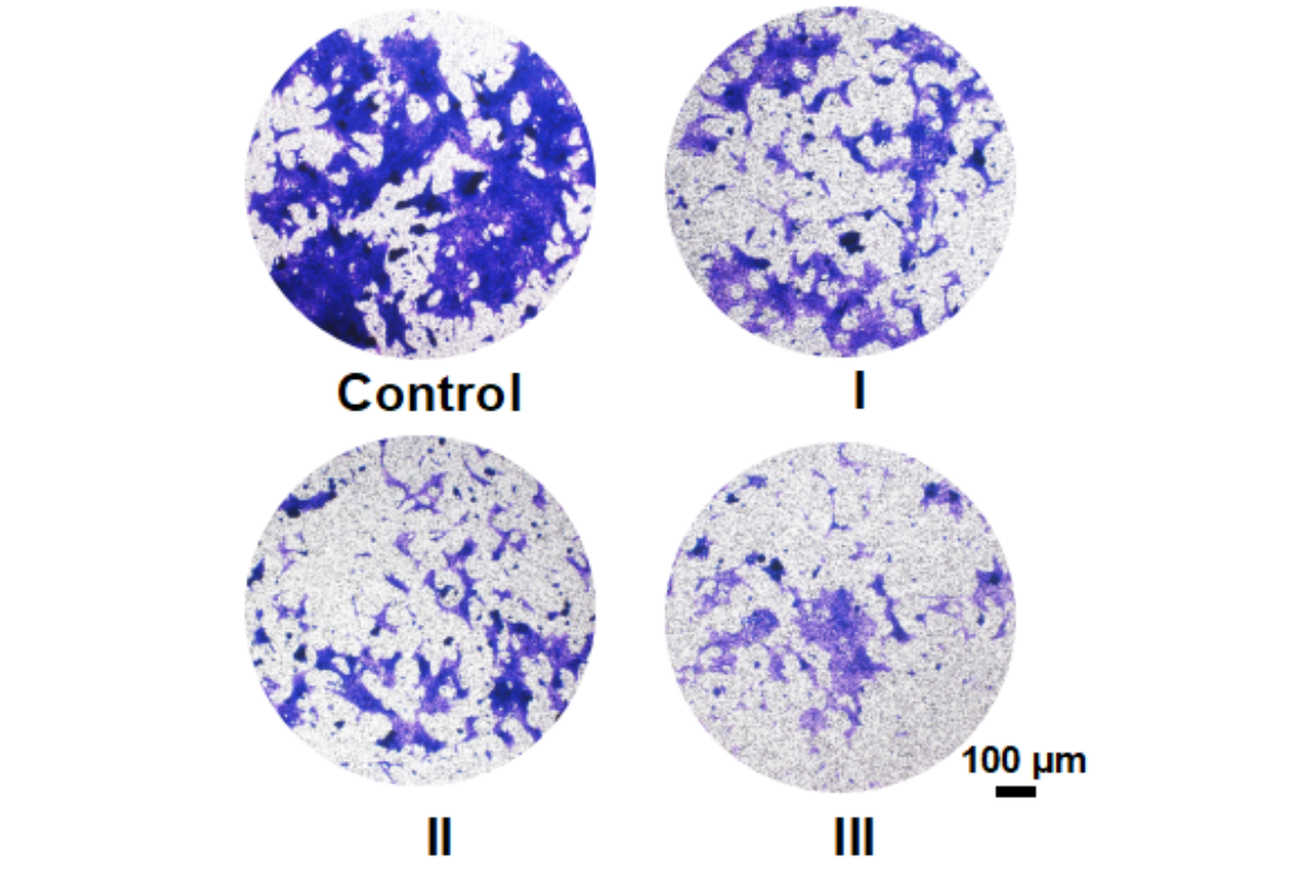Cell Invasion Assay: Murine Breast Cancer (4T1) Cell Invasion Model