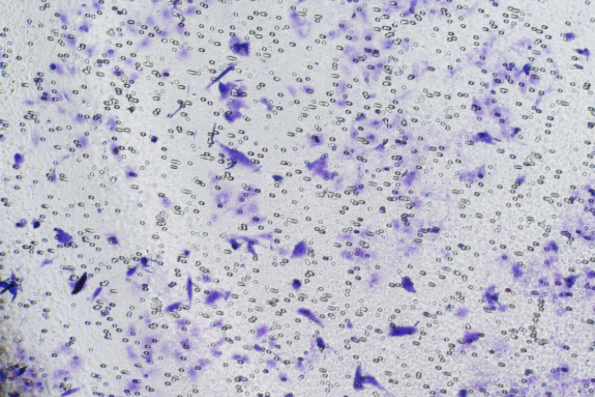 Cell Invasion Assay: Human Liver Cancer (Huh7) Cell Invasion Model
