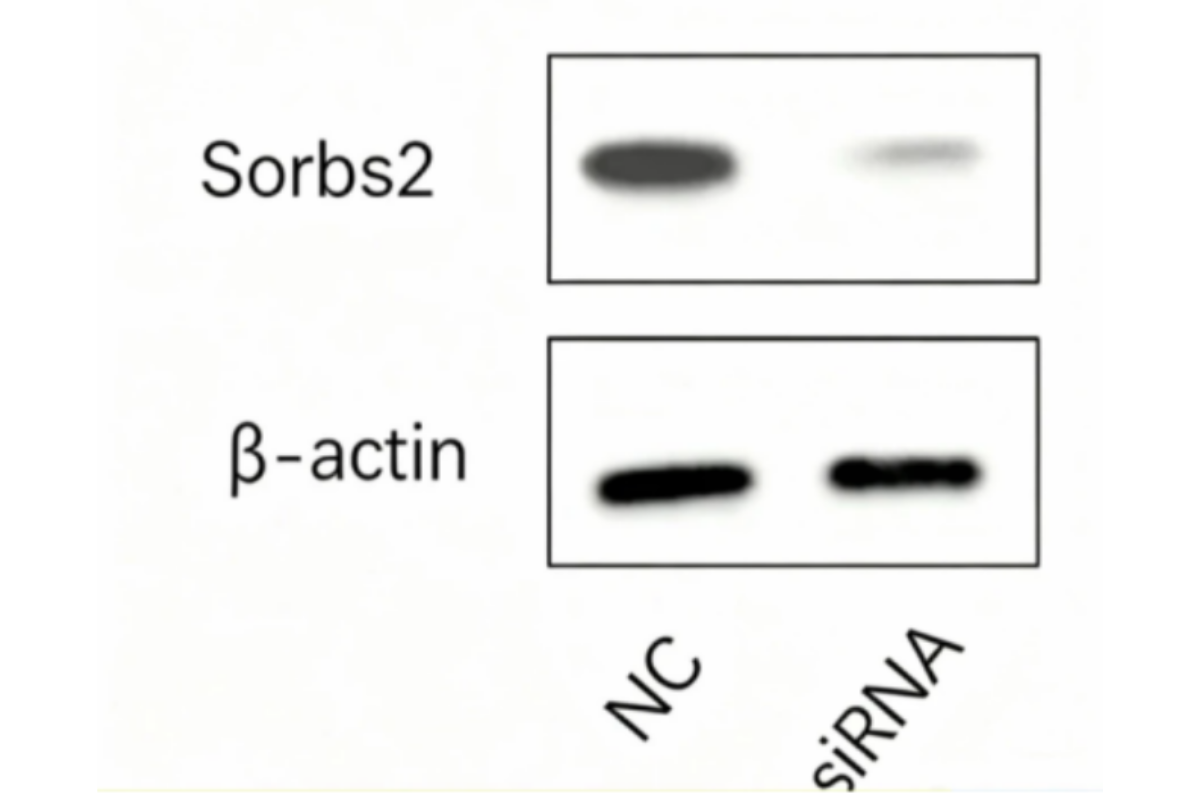 Cell Transfection | H9c2 (Rat Cardiomyocyte) Cells Transfection – siRNA