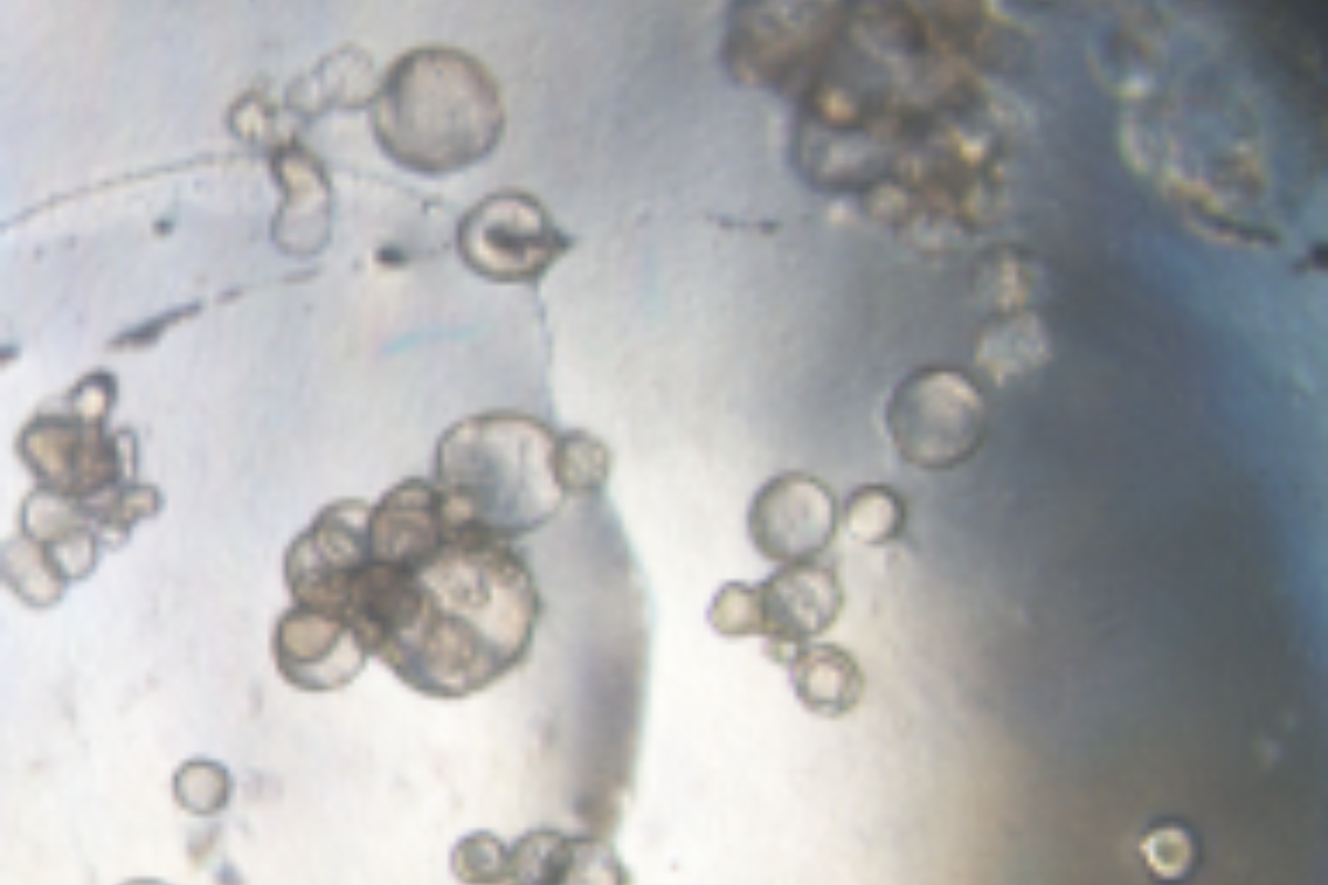 Organoid Construction | Mouse Cochlear Organoid Culture Case