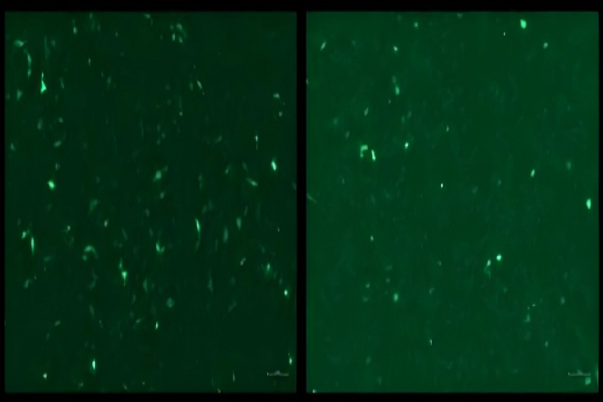 Cell Transfection | HepG2 Human Hepatocellular Carcinoma Cells Transfection – DNA