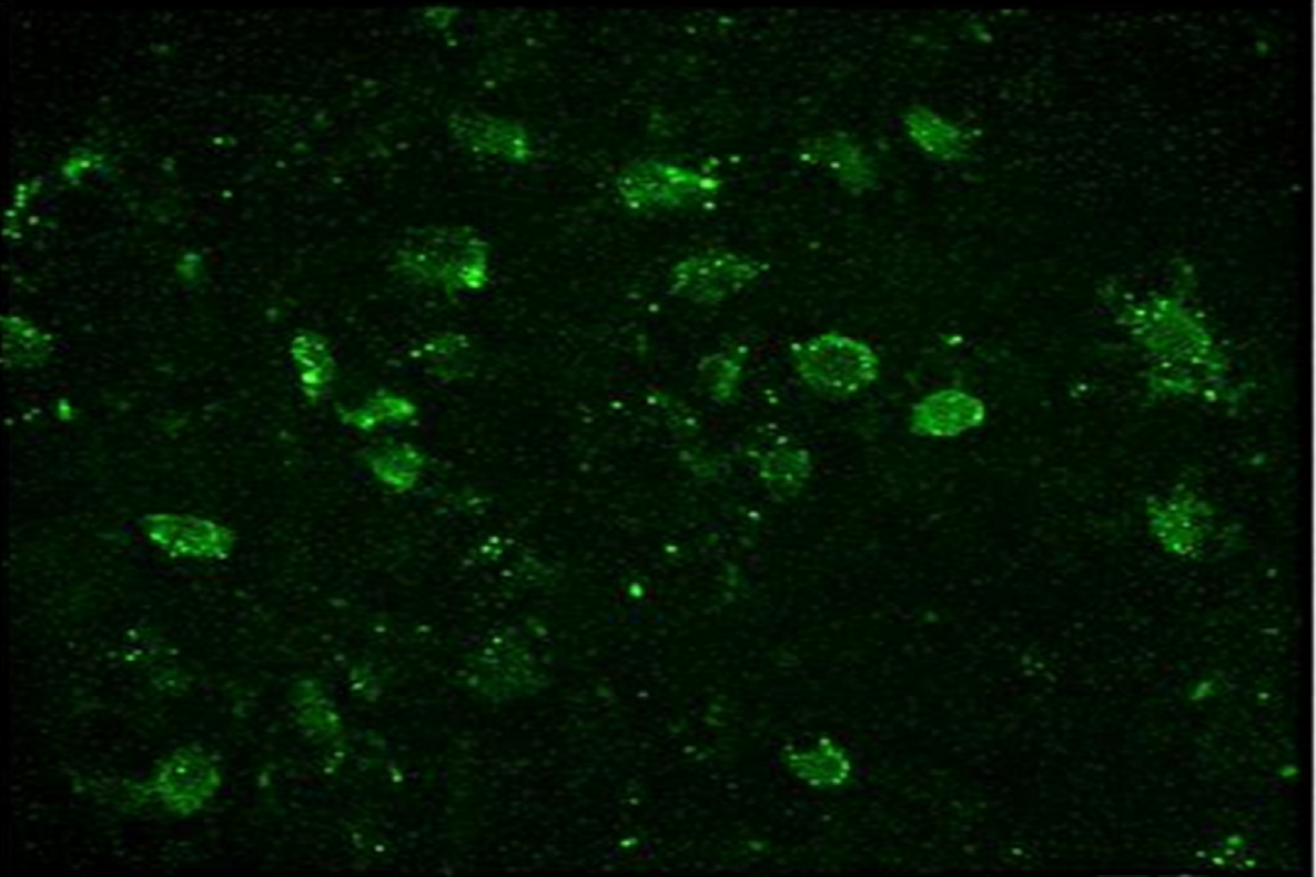 Cell Transfection | LLC (Mouse Lewis Lung Carcinoma) Cells Transfectio
