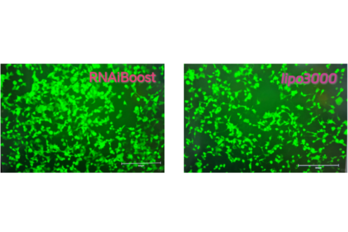 Cell Transfection | HEK293 (Human Embryonic Kidney Cell) Cells Transfection – saRNA