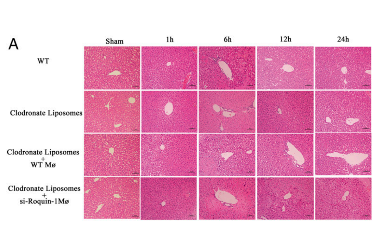 Macrophage Depletion Case Studies
