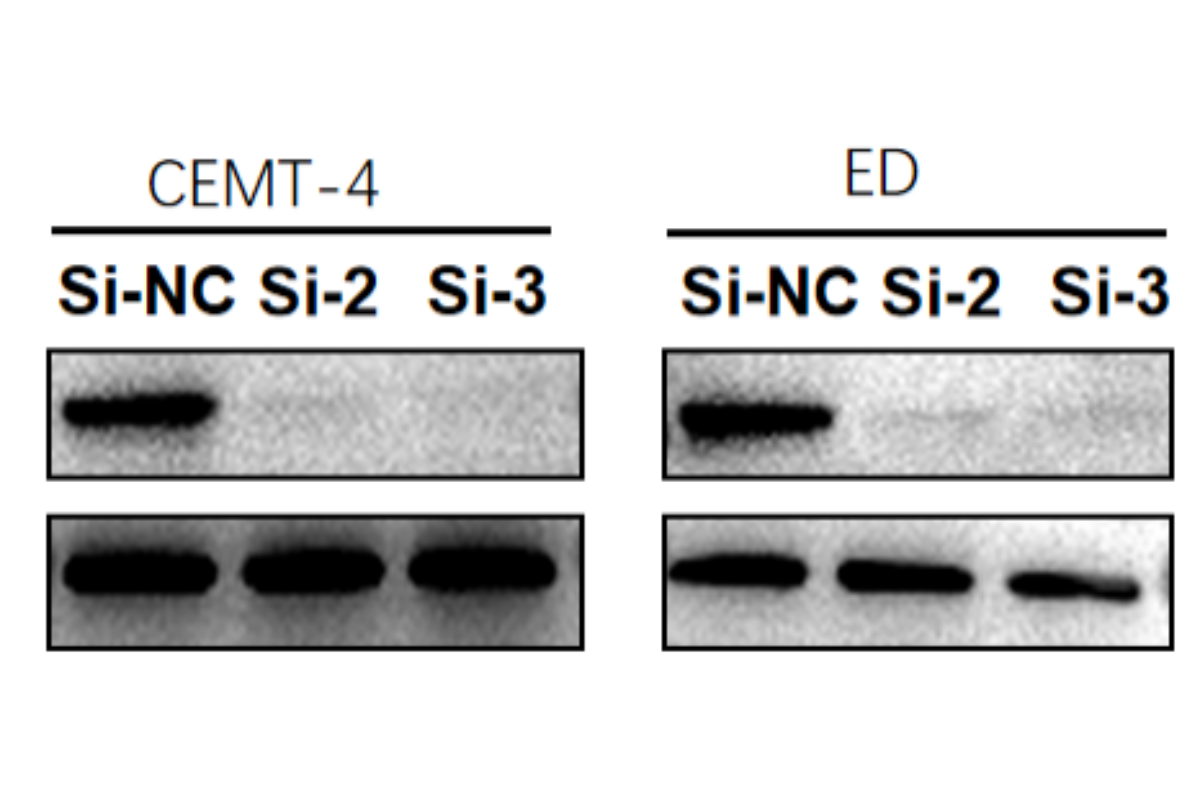 Cell Transfection | CEMT-4 (Human T-cell leukemia cell) Cells Transfection – siRNA