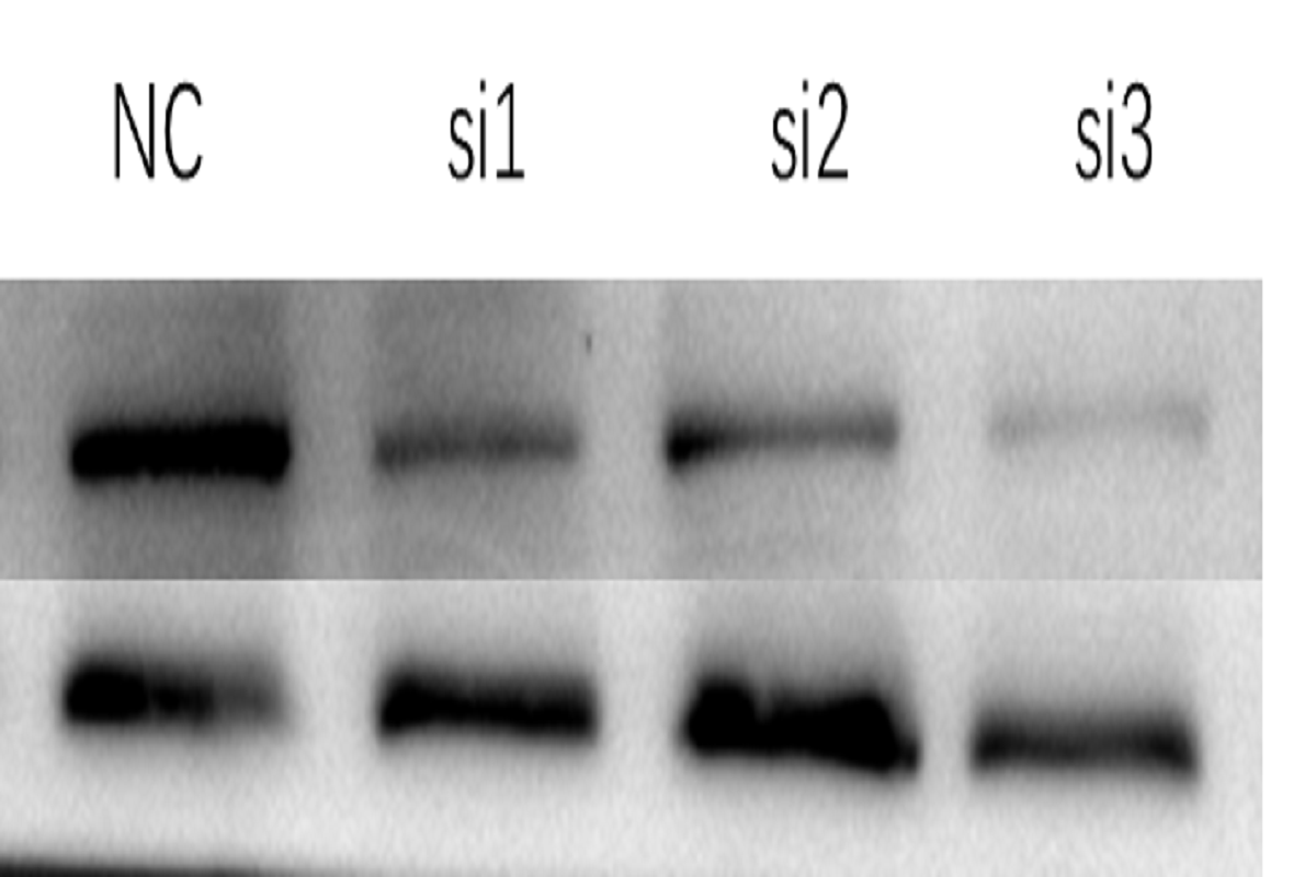 Cell Transfection | H9C2 rat cardiomyoblasts cell Transfection – siRNA