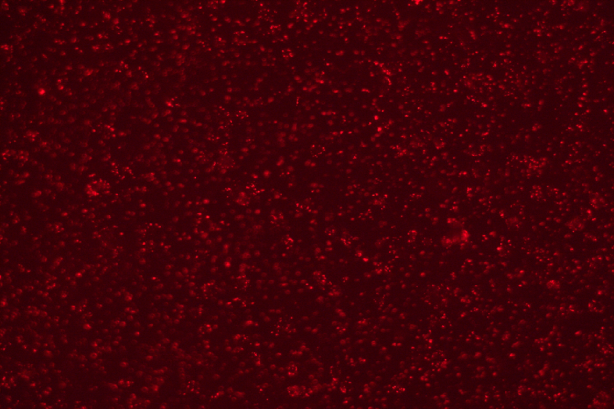 Cell Transfection | NCI-H520 (Human Lung Squamous Carcinoma Cells) Transfection – siRNA