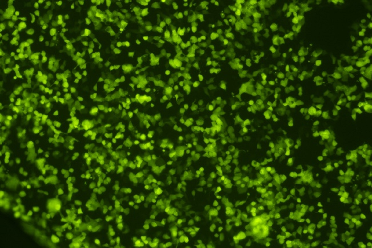 Cell Transfection | HEK293 Human Embryonic Kidney Cells Transfection