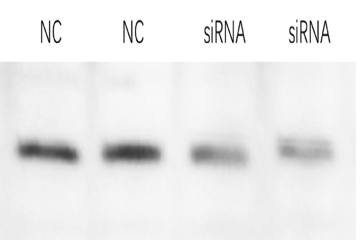 Cell Transfection | HK-2 human renal proximal tubular epithelial cell Transfection – siRNA