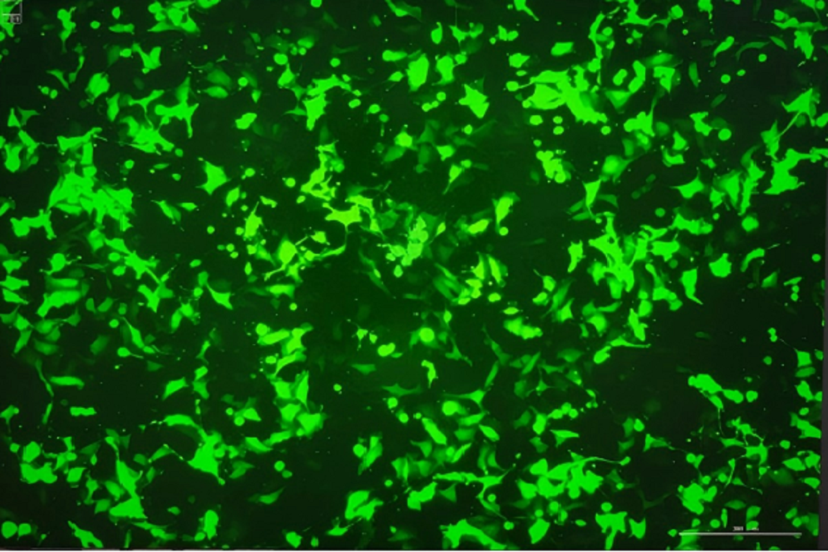 Cell Transfection | Transfection of S18 (Human Nasopharyngeal Carcinoma Cells)-DNA