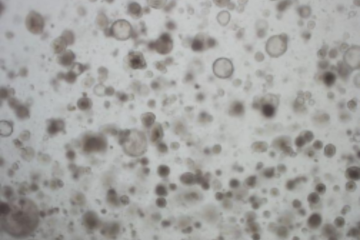 Organoid Construction | Mouse Colonic Organoid Culture Case