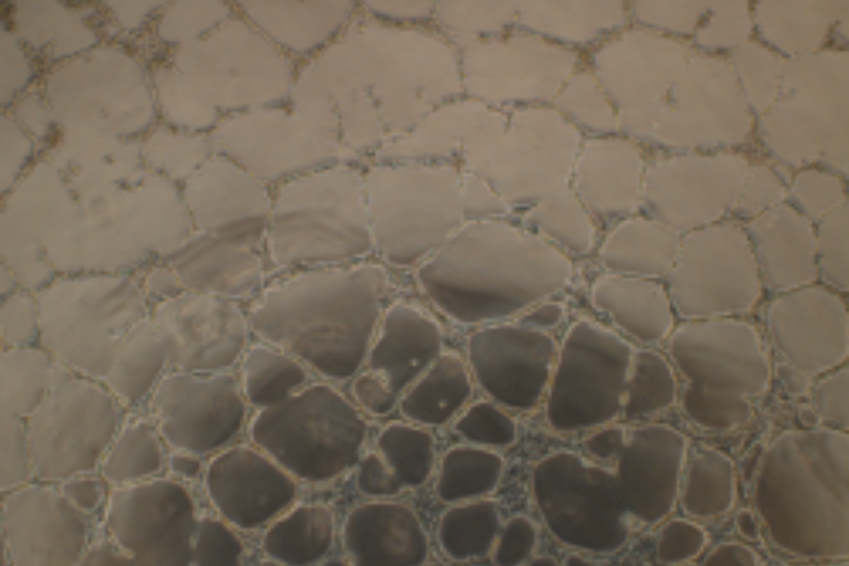 Angiogenesis Assay Case Study 1