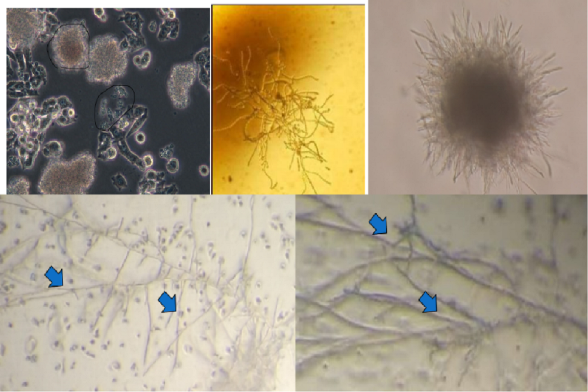Troubleshooting Cell Culture Contamination: A Practical Solution Guide