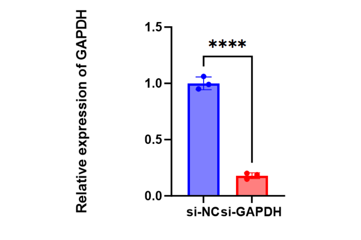 Cell Transfection | THP-1 (Human monocytic leukemia cell) Cells Transfection – siRNA