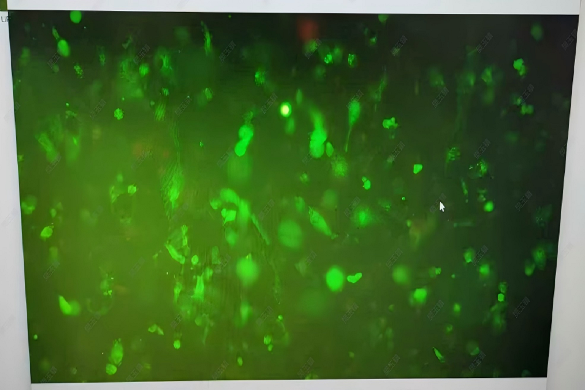 Cell Transfection | Transfection of Primary HUVEC (Human Umbilical Vein Endothelial Cells)-DNA